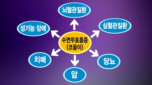 코골다 사망?! 수면무호흡증이란 | MBC 연예 스포츠