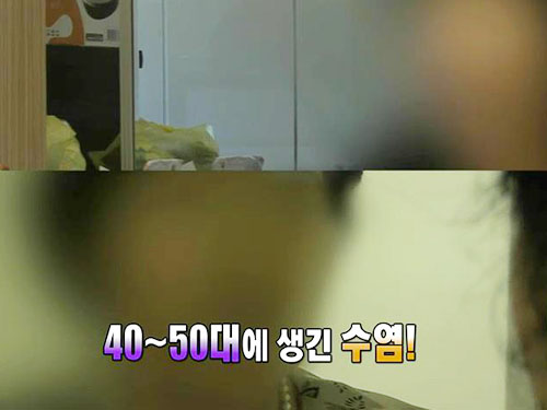 콧수염에 턱수염까지~ 아내가 남자같이 변하고 있어요 이미지-3