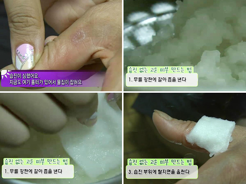 딸꾹질엔 00, 두통엔 00! 알수록 신기한 민간요법 이미지-5
