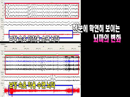 보정속옷, S라인 얻고 건강 잃는다? 이미지-6