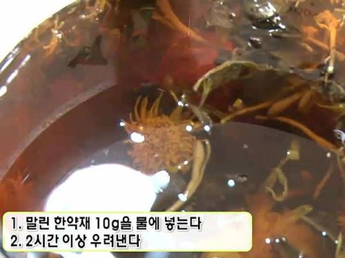 찬바람이 불면 괴롭다! 여성들의 은밀한 고민 ‘치질’ 이미지-6