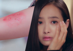 <아름다운 비밀> 화상에 따귀까지! 구박 받는 빅토리아, '짠하네' (미려적 비밀)