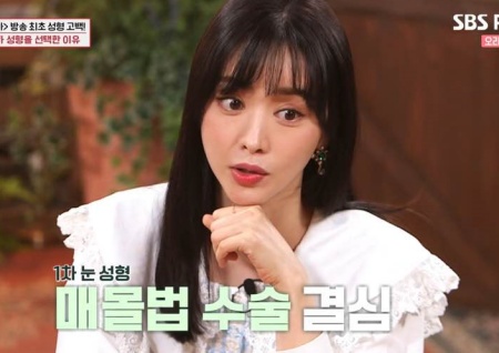 '밥심' 홍수아 "성형 논란? 후회는 없어… 더이상 수술은 없을 것" 선언