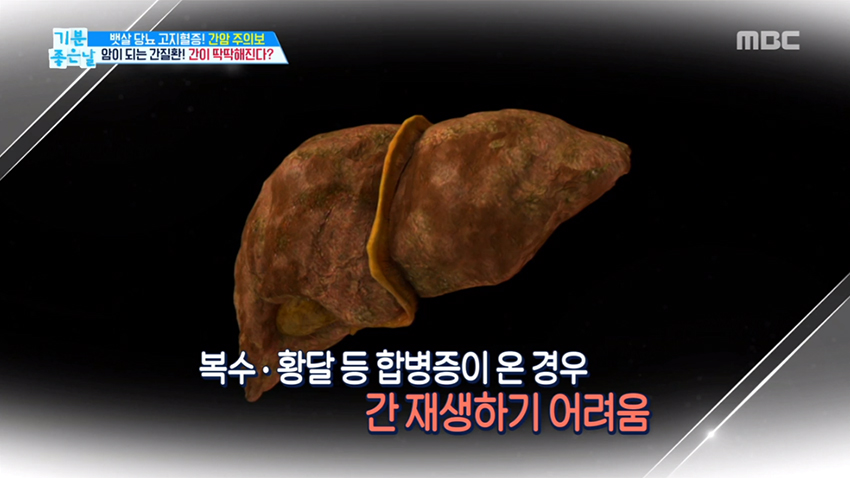 놔두면 간암이 된다? 간질환 제대로 알고 예방하자!