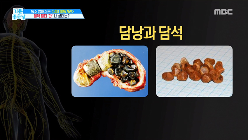 내 몸의 혈액 필터 '간' 내 간의 상태는?