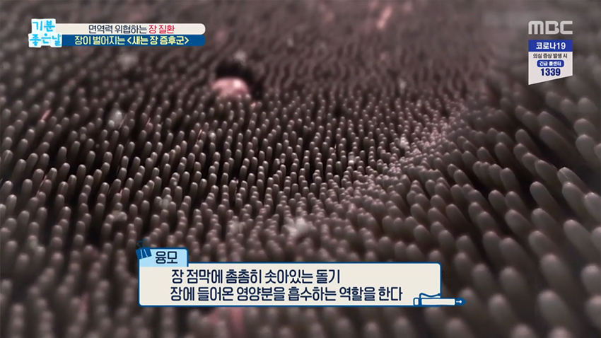 면역력 위협하는 장 질환, 장이 벌어지는 ＜새는 장 증후군＞