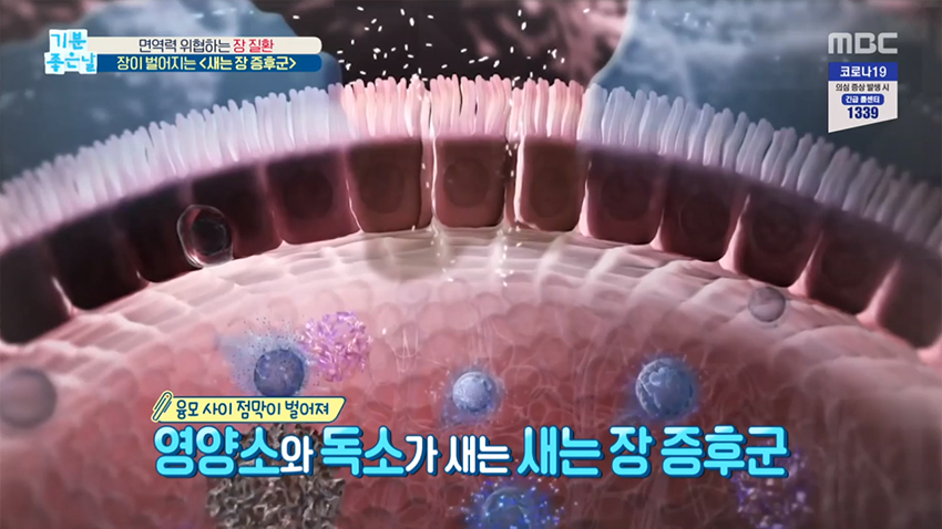 면역력 위협하는 장 질환, 장이 벌어지는 ＜새는 장 증후군＞