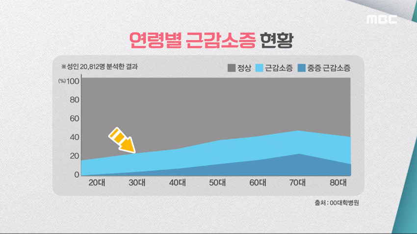 기분 좋은 날] 장수의 비결 근육! 근감소가 시작되는 시기는?!