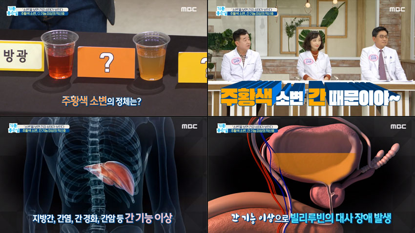 소변 색으로 알아보는 내 건강상태!