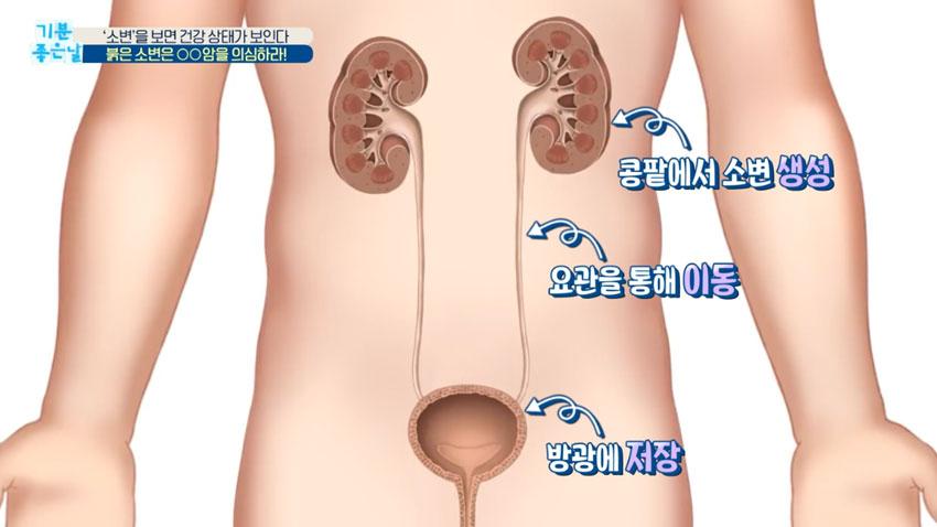 소변 색으로 알아보는 내 건강상태!