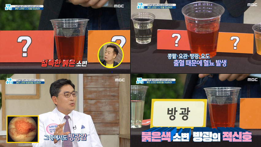 소변 색으로 알아보는 내 건강상태!