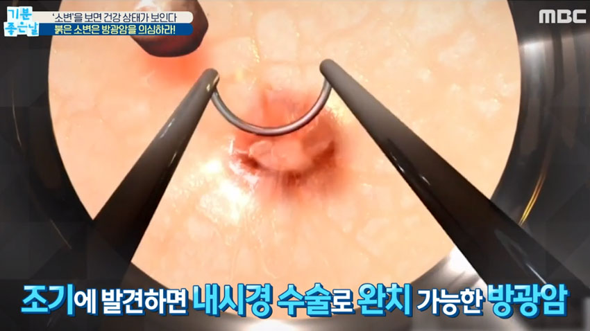 소변 색으로 알아보는 내 건강상태!