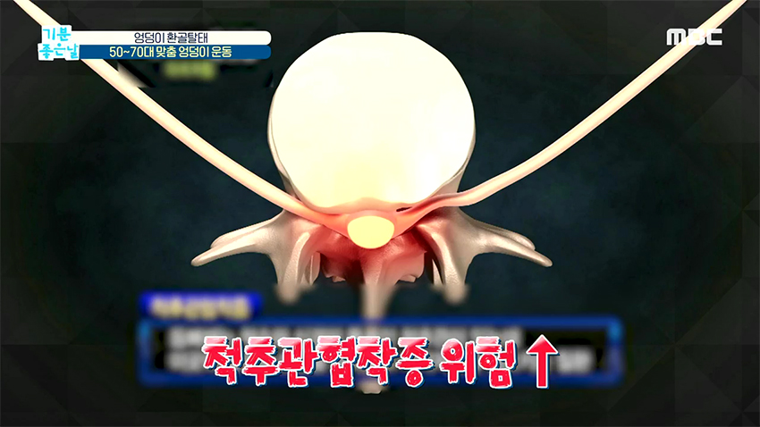 엉덩이도 연령별 맞춤 운동이 있다? 애플힙 만드는 엉덩이 운동!
