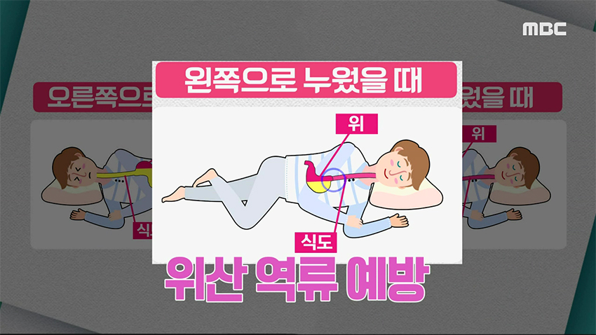 자고 일어나면 몸이 뻐근하다? 내가 조심해야 되는 수면 자세는?!