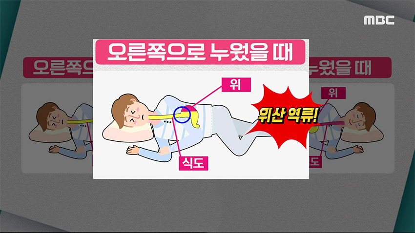 자고 일어나면 몸이 뻐근하다? 내가 조심해야 되는 수면 자세는?!
