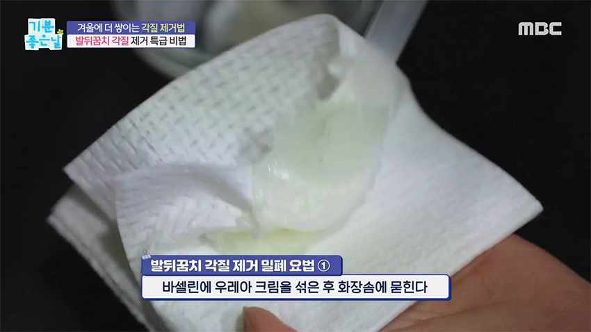 발뒤꿈치 각질 관리하는 초간단 비법 (Ft. 밀폐 요법)
