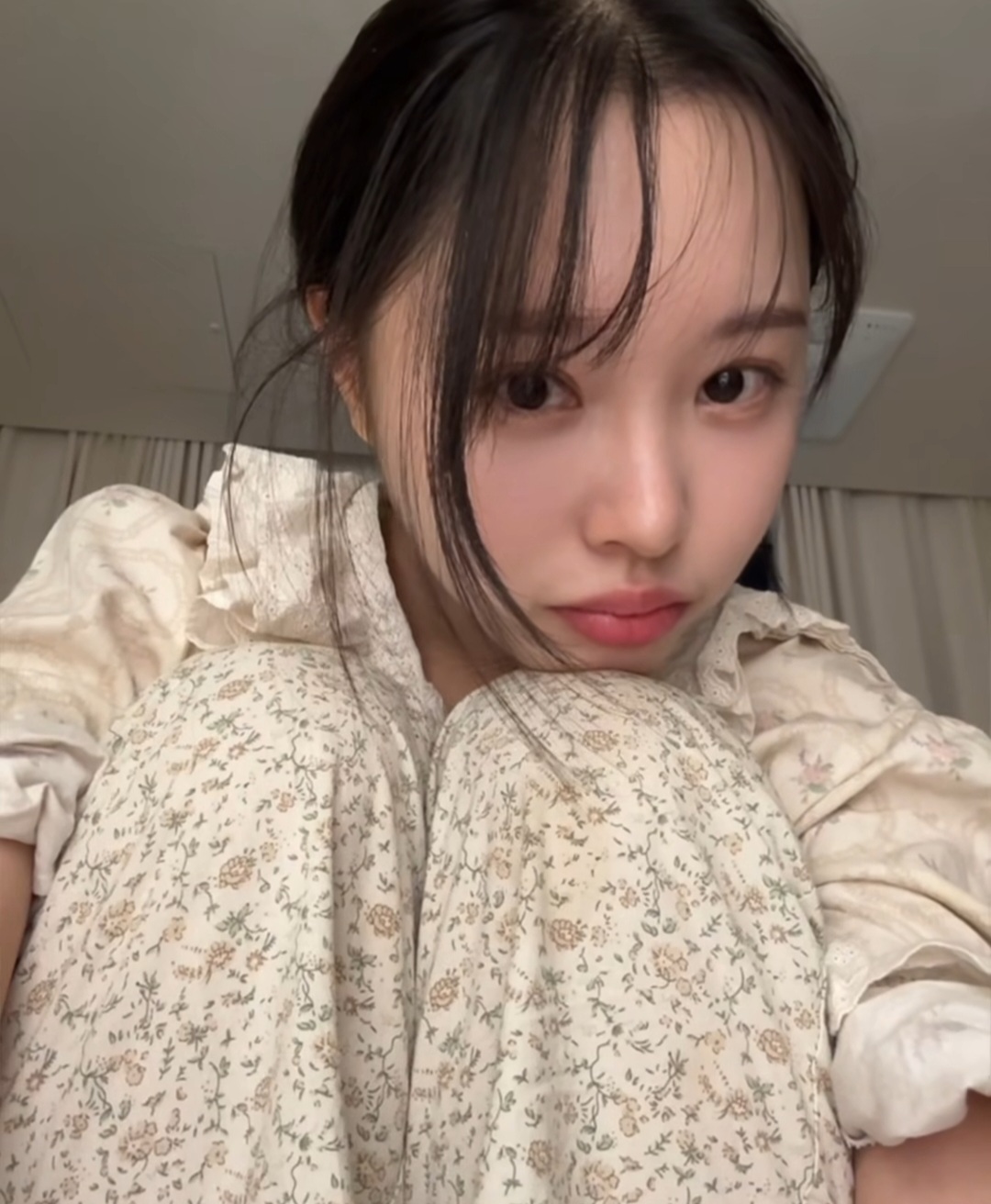 ‘박성광♥’ 이솔이, 암투병 고충 토로 “속눈썹 다 빠지고 손도 까매져”