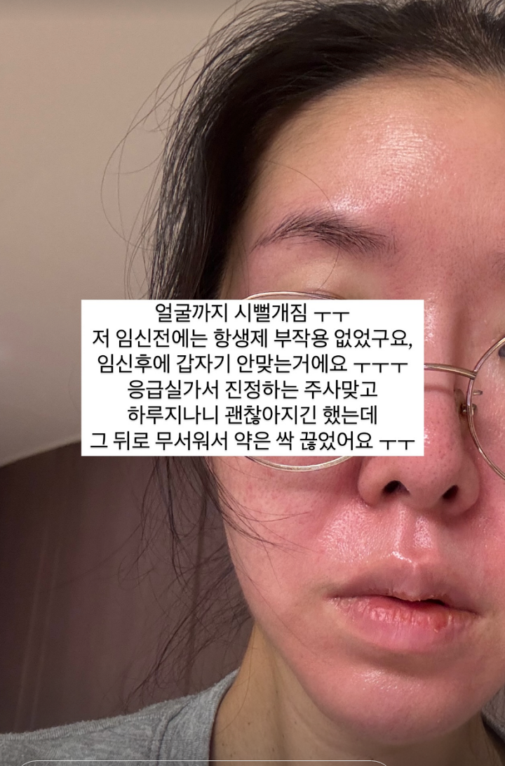 '♥최성욱' 김지혜, 임신 중 항생제 부작용에 응급실 行 "임신 쉽지 않다"