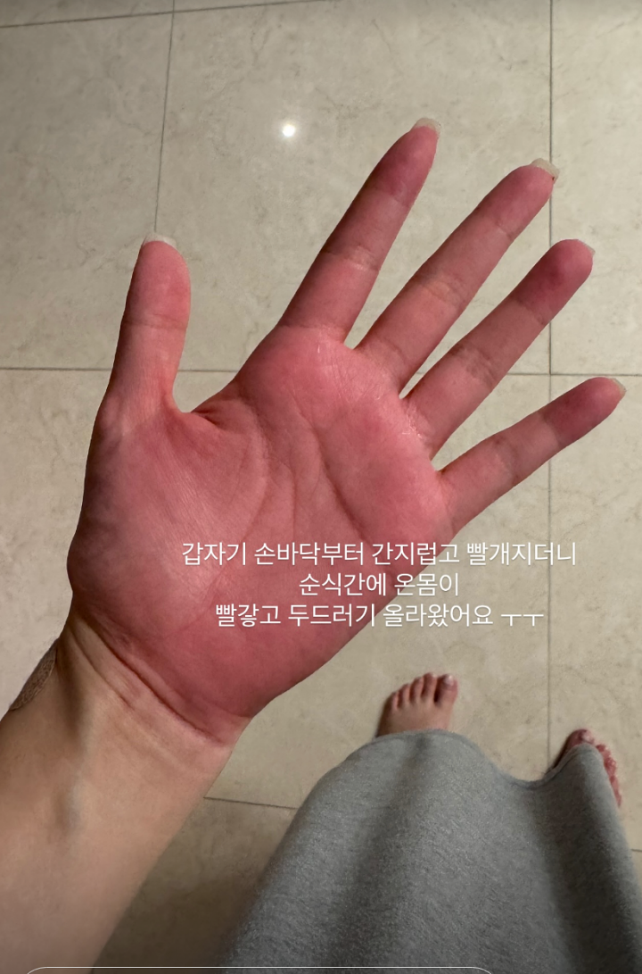'♥최성욱' 김지혜, 임신 중 항생제 부작용에 응급실 行 "임신 쉽지 않다"
