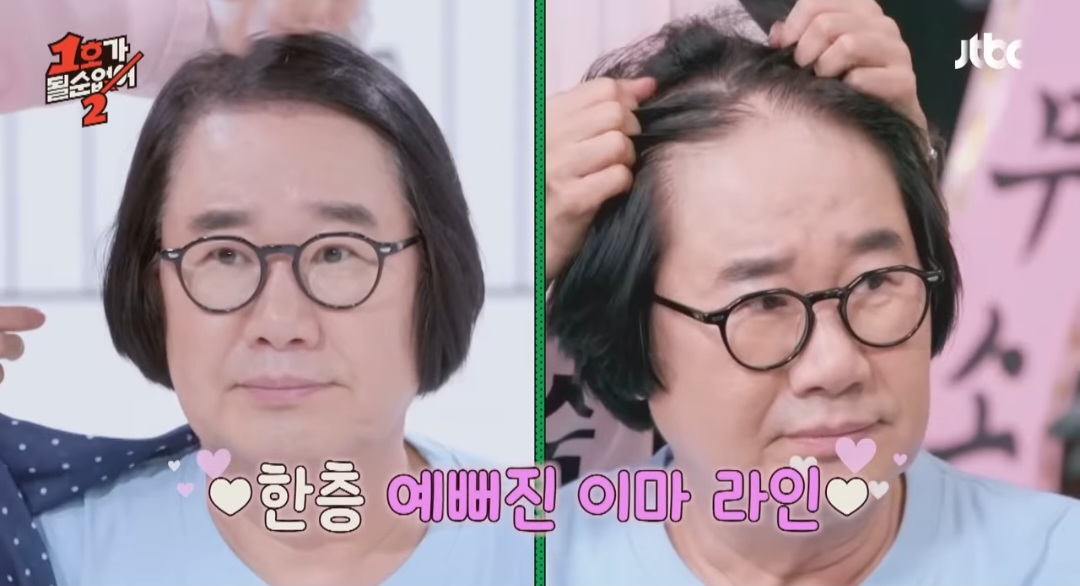 최양락, 쌍꺼풀수술 이어 모발이식까지…달라진 얼굴 눈길 (1호가)