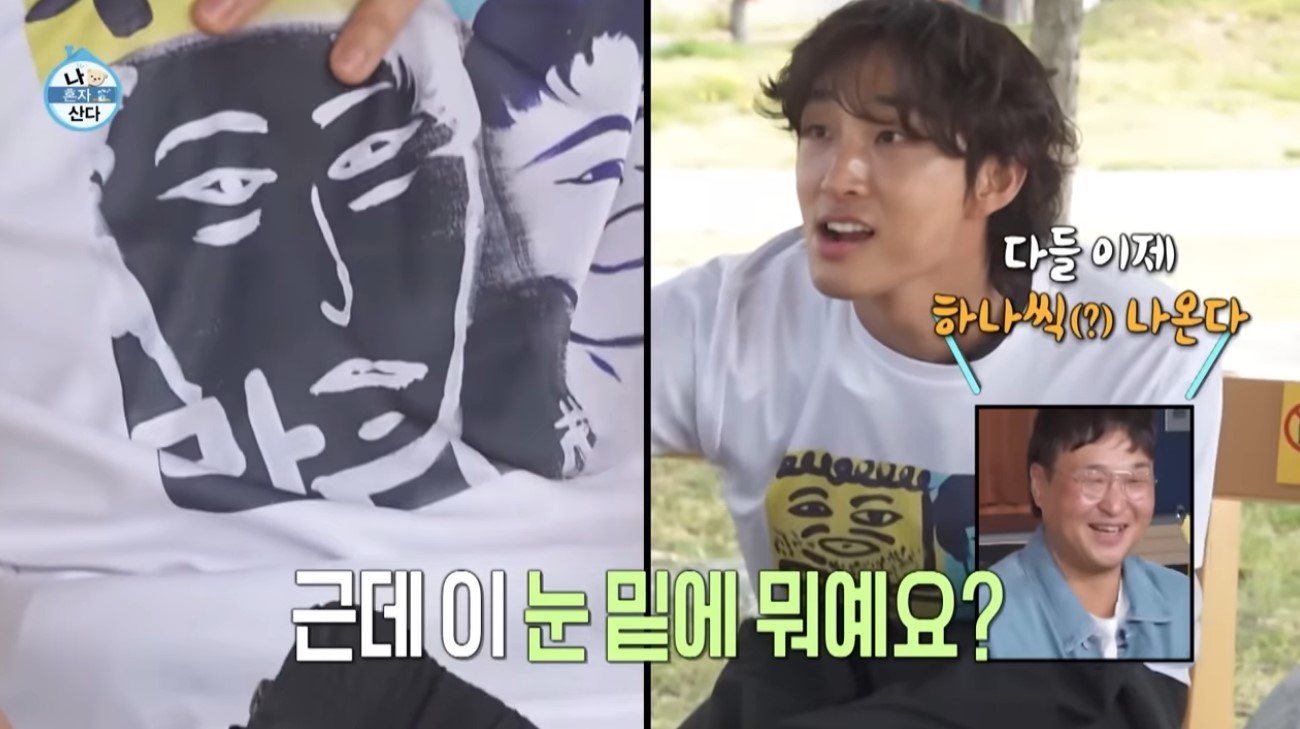 ‘나혼산’ 배나라, 눈 밑 지방 재배치 시술 고백 “두 번 하는 경우도”